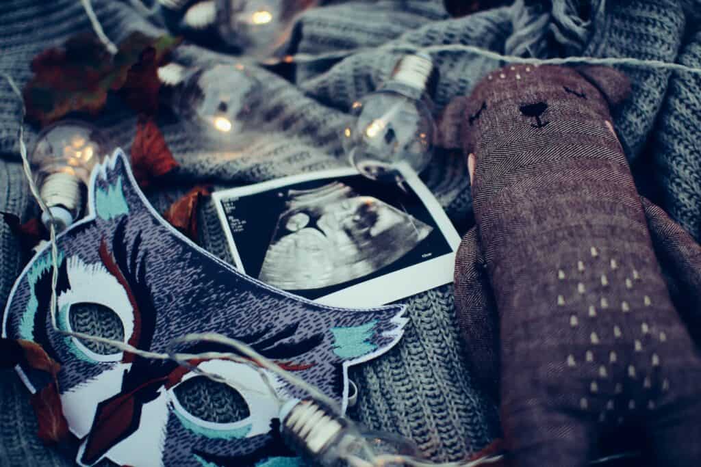 ultrasound photo surrounded by string lights, recurrent pregnancy loss